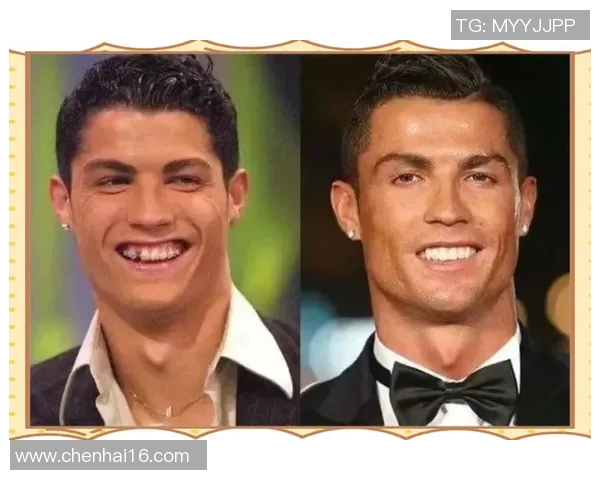 足球明星正畸前后对比图集展示他们的微笑与自信变化